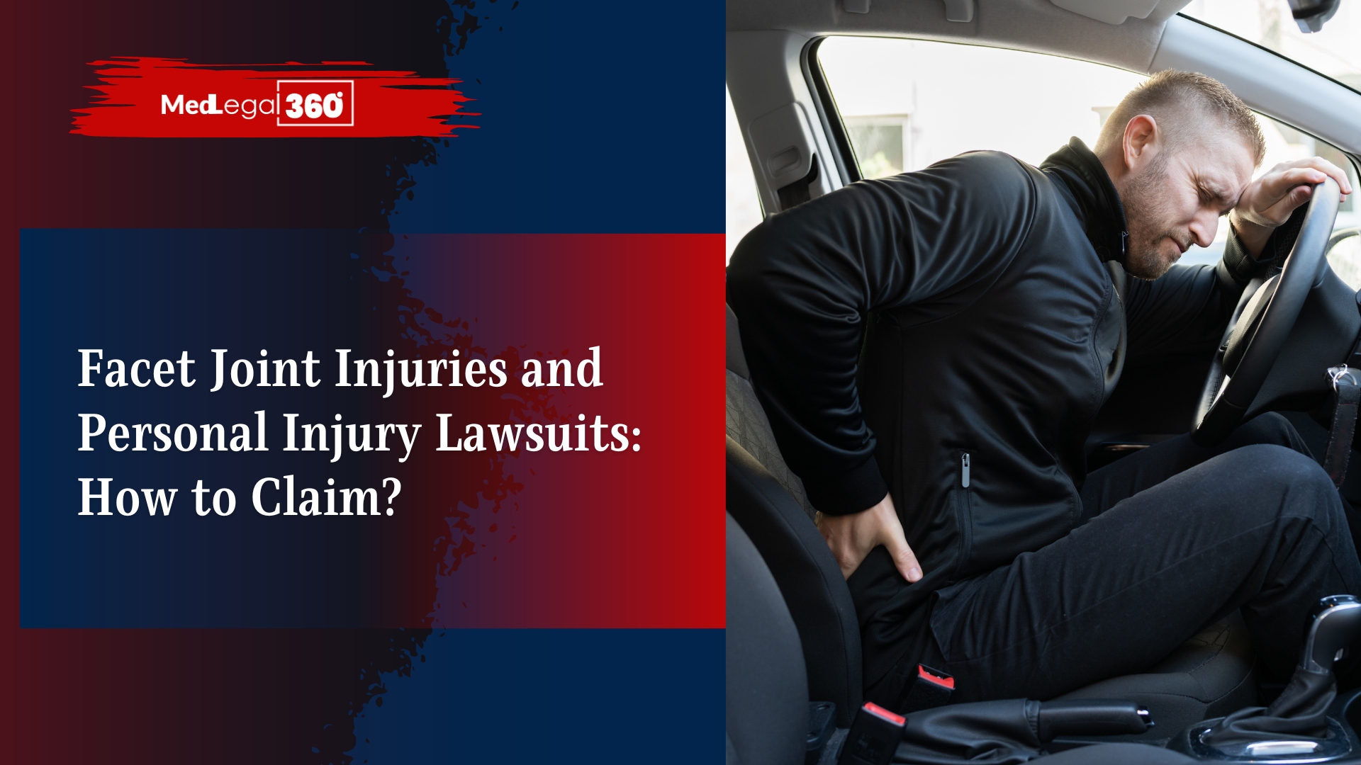 Facet Joint Injuries and Personal Injury Lawsuits: How to Claim?