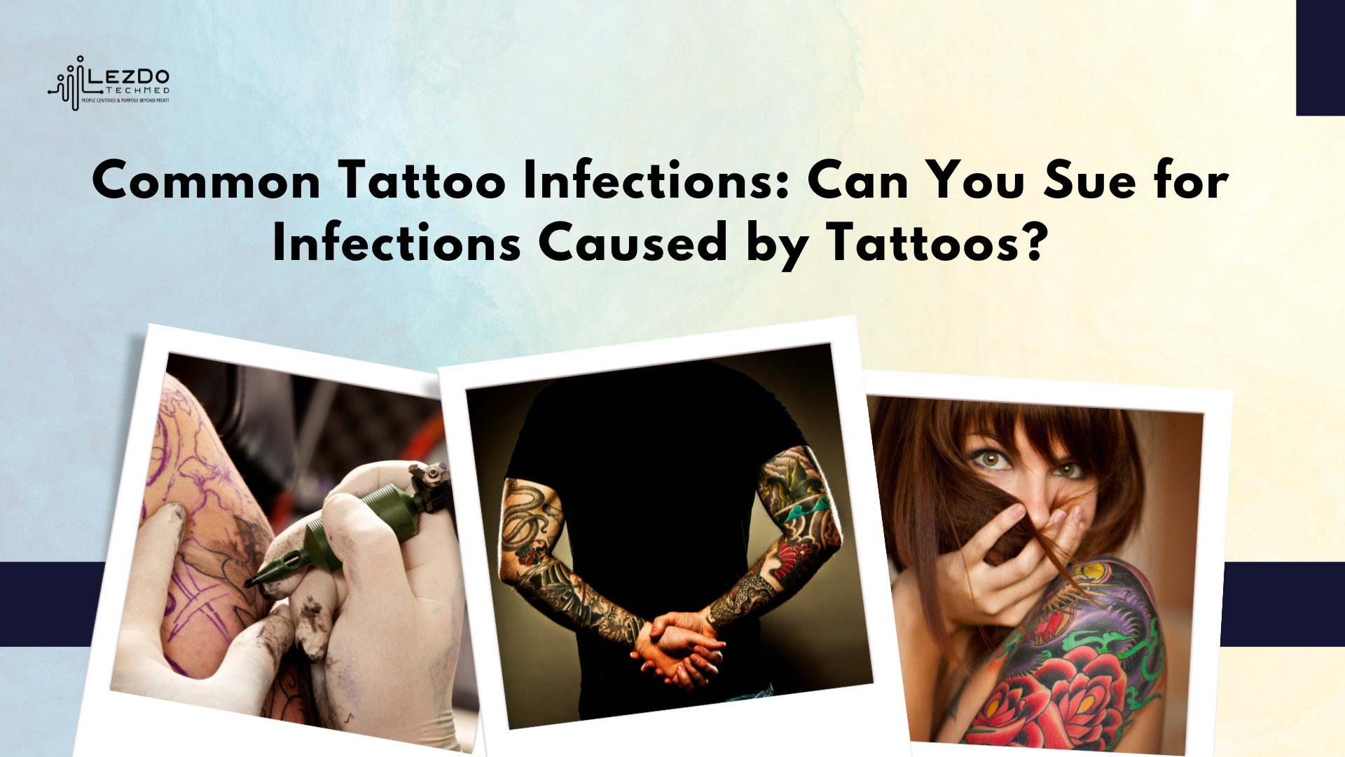 Common Tattoo Infections: Can You Sue for Infections Caused by Tattoos?