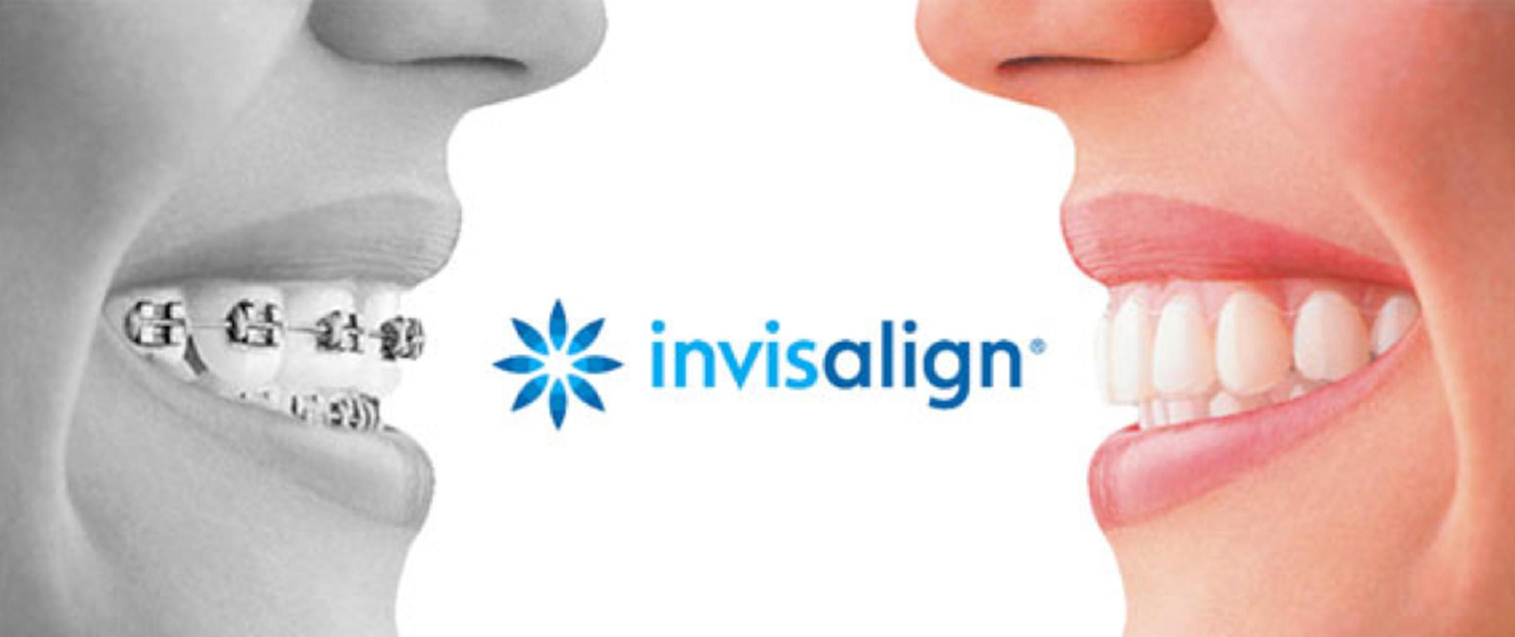 Best Invisalign Dentist Lewisville - Invisalign Specialist Carrollton, The Colony Texas