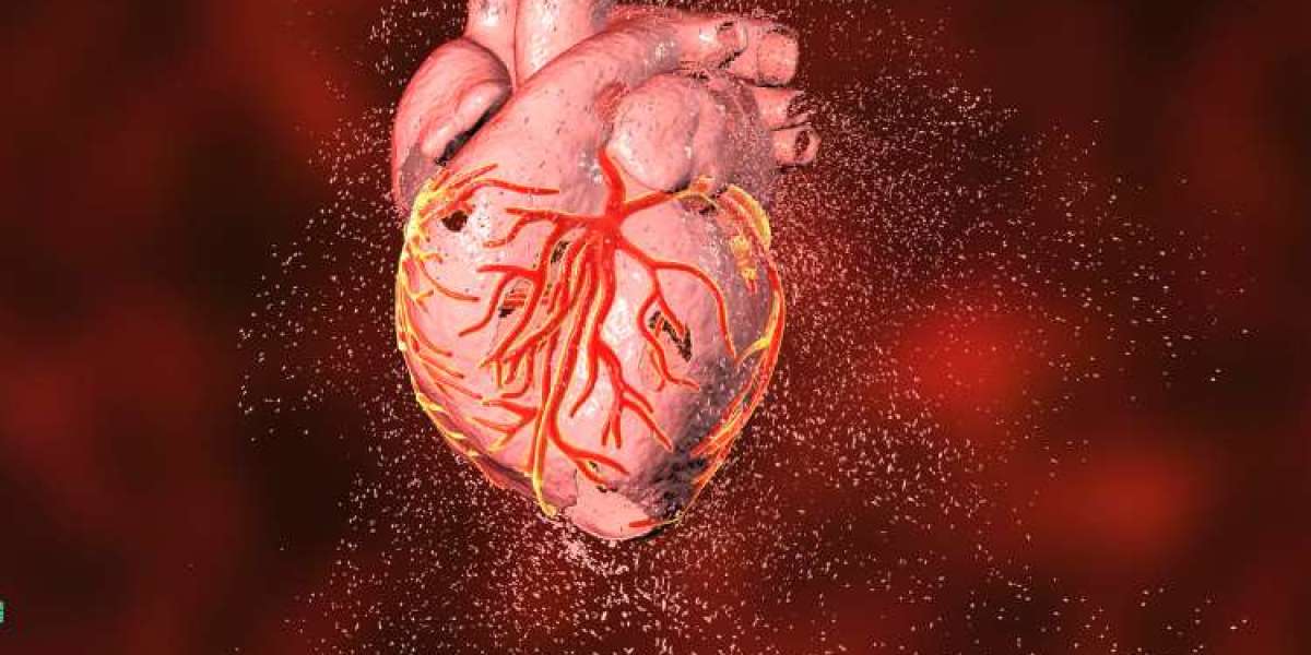 Myocardial Infarction Market Size and Global Forecast Report 2024-2032