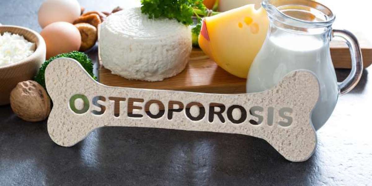 Global Osteoporosis Drugs Market will be US$ 25.53 Billion by 2032