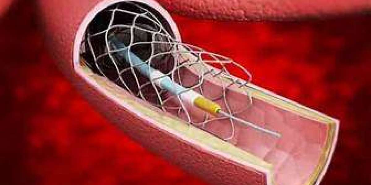 Embolic Protection Device Market Size And Forecast Report 2024-2032