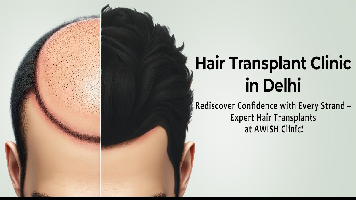 Hair Restoration Hair Transplant: Procedure, Benefits & Cost at AWISH CLINIC