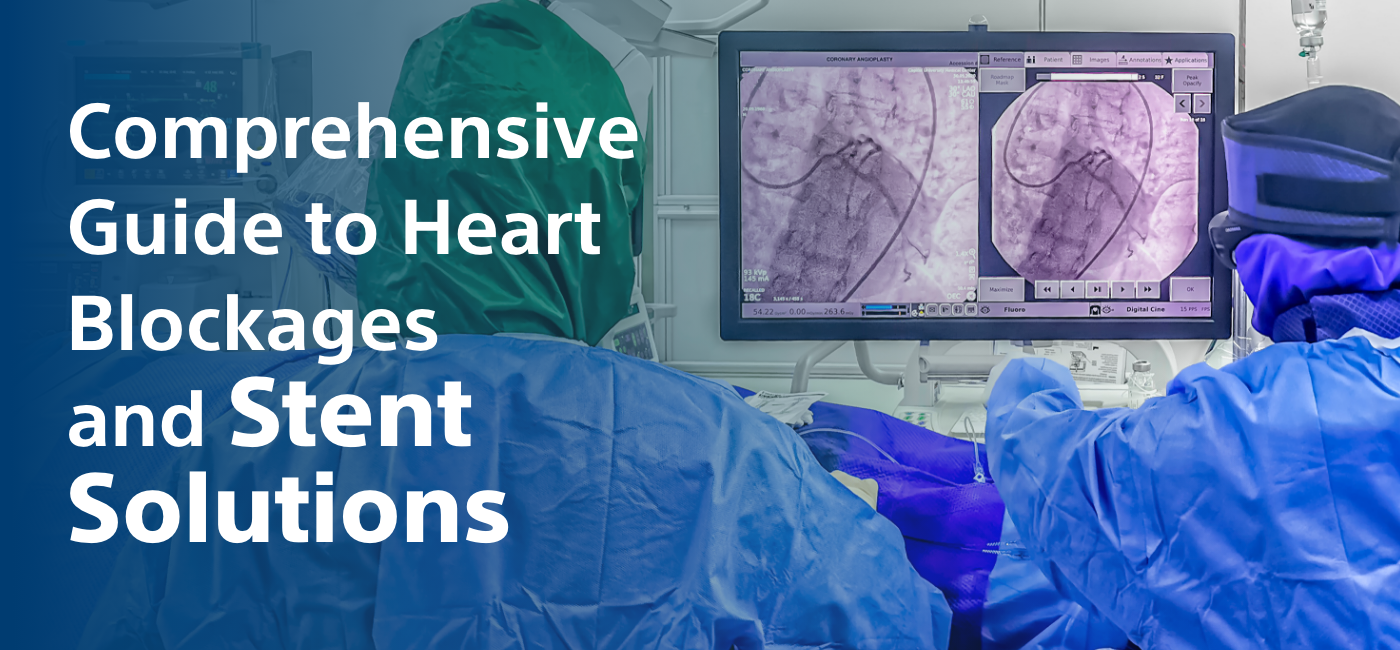 Comprehensive Guide to Heart Blockages and Stent Solutions - PenCraftedNews