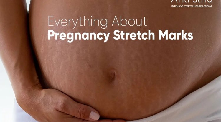 How to Use Stretch Mark Creams Effectively During Pregnancy? - Omaha News Wire