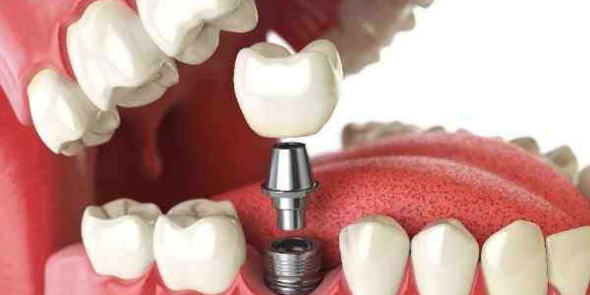 How Smoking Affects Oral Health in Basildon