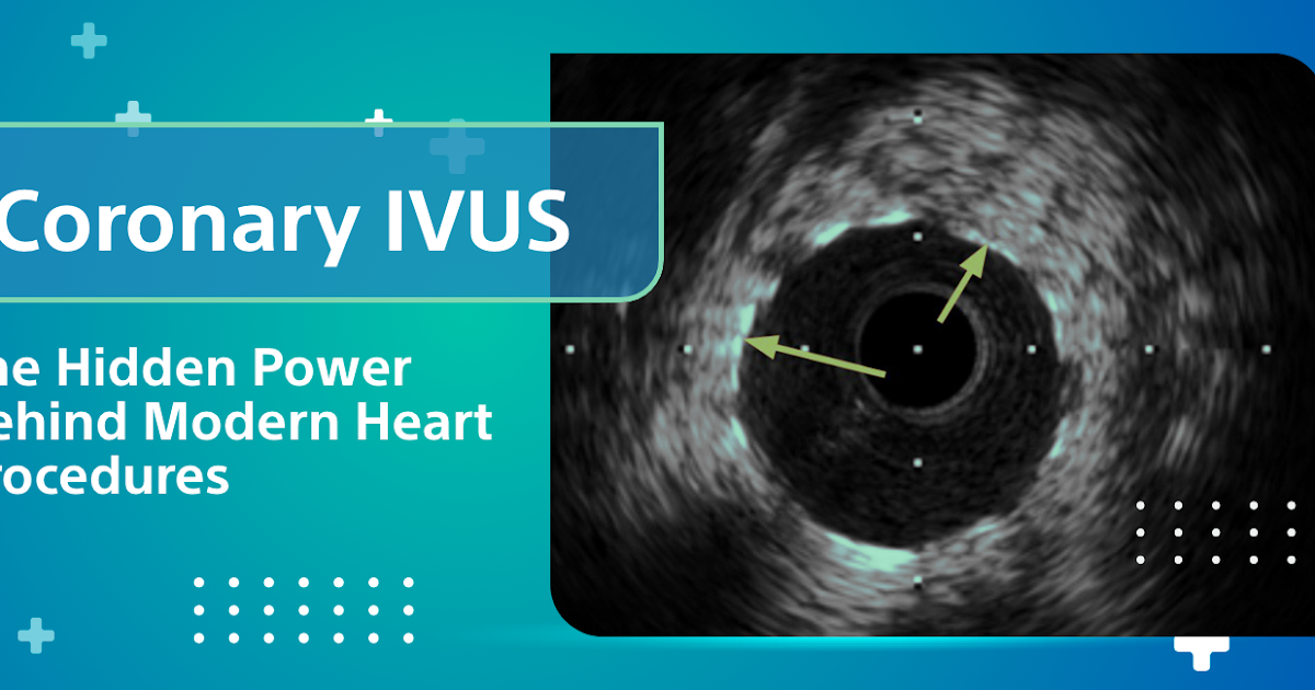 Coronary IVUS: The Hidden Power Behind Modern Heart Procedures