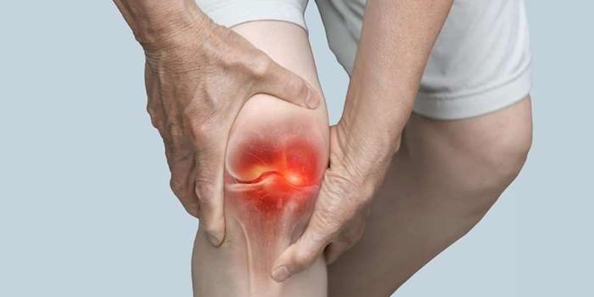 https://www.facebook.com/Arthro.MD.Cream.Australia.Price/