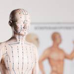 Chennai Acupuncture
