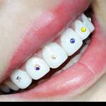chandak dental Dental