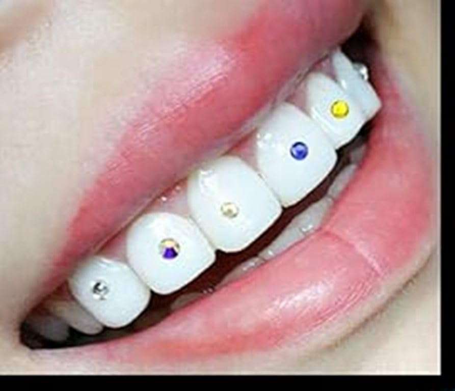 chandak dental Dental